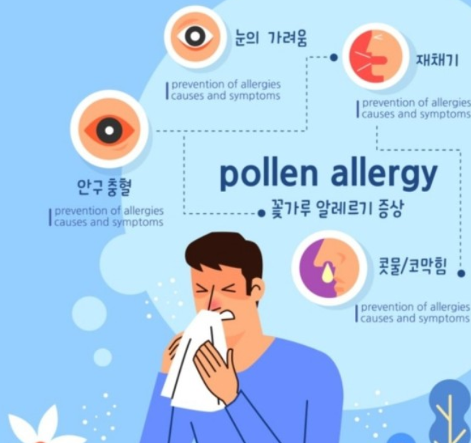 “이것도 알레르기였어?”, 종류도 다양 - 라이프 뉴스 - Korea Daily Times 코리아 데일리 타임스ㅡ